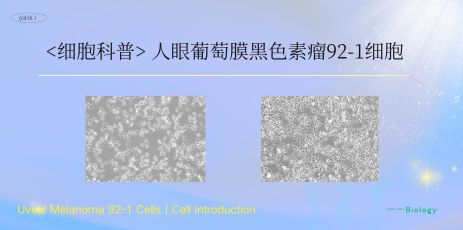 细胞科普——人眼葡萄膜黑色素瘤92-1细胞